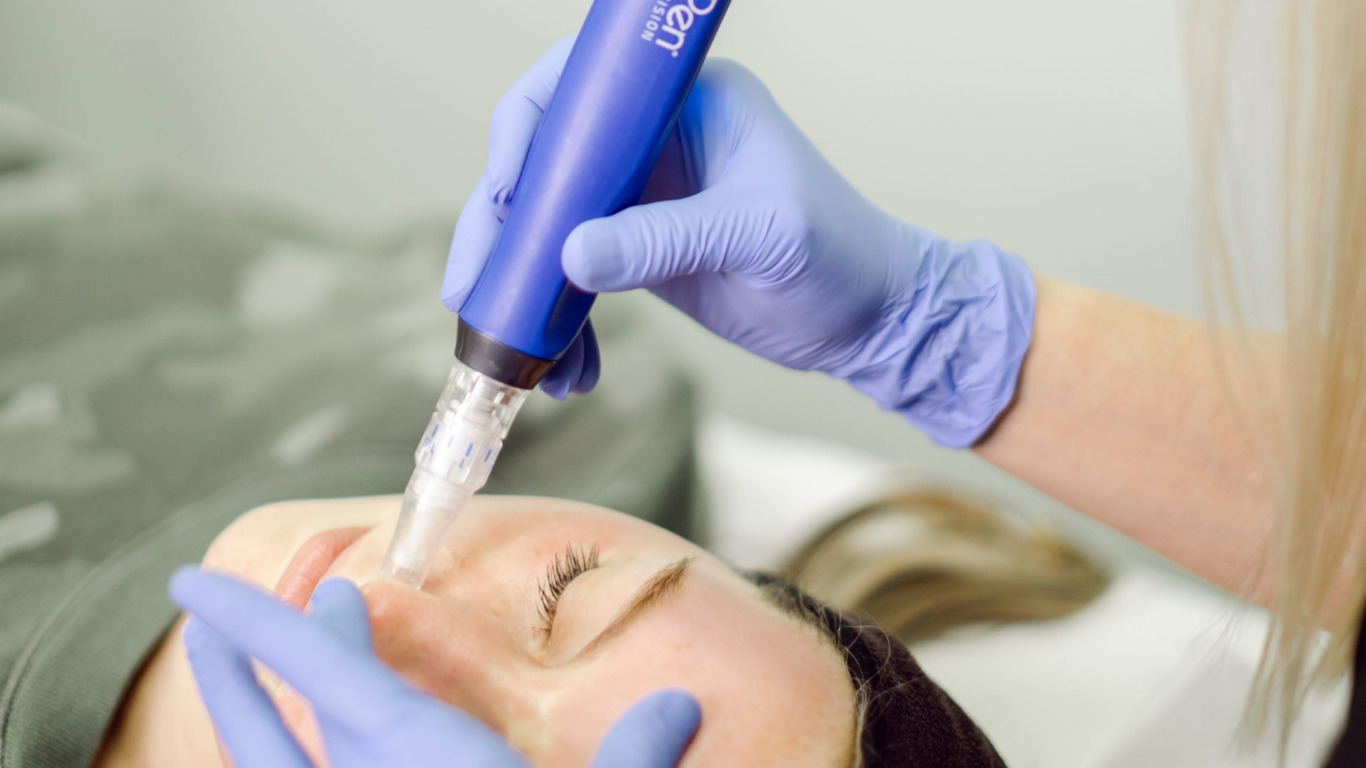 Get $100 Back on SkinPen Microneedling at Revive Beauty & Wellness